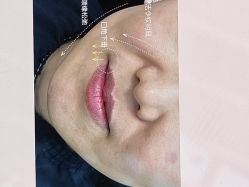 点击看大图 -Yestar 嘉兴艺星医疗美容医院