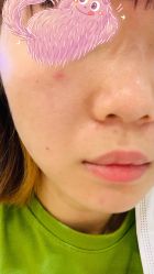 -正璞医疗美容·皮肤修复·微整注射