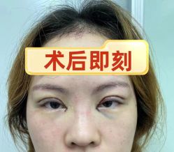 -素美医疗美容·西南眼鼻整形·修复基地