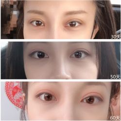 -美莱医学美容医院