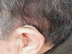 -安湃声助听器(密云店)