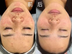 -Cream88颜皮肤管理中心