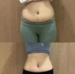 -Lily纤美·科技减脂中心