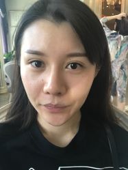 点击看大图 -禾美嘉医疗美容
