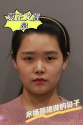 -北京米扬丽格医疗美容·联合丽格鼻整形中心