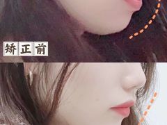 -极光口腔·矫正种植修复(锦江店)