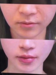 -郡艺医疗美容·微整·眼鼻吸脂