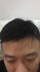 点击看大图 -乐绅男士高端假发定制