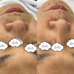 -蕾特恩专业祛痘·皮肤管理
