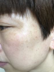 -痣缘宫
