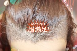 -大麦微针植发全国连锁