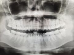 -宁波口腔医院(鄞州分院)