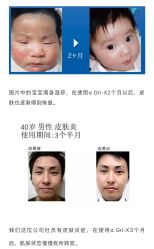 -MZ SKIN CARE逆齢驻颜中心