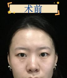 -素美医疗美容·西南眼鼻整形·修复基地
