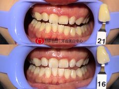 -同步齿科·数字化正畸种植口腔中心(珠海店)