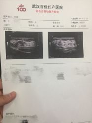 -武汉百佳妇产医院
