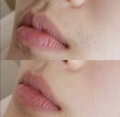-MUSES专业脱毛比基尼サロン日式连锁