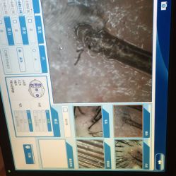 iphone_upload_pic-史云逊养发中心