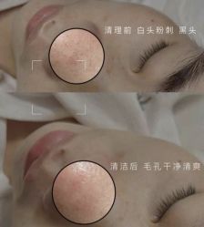 -Cream88颜皮肤管理中心