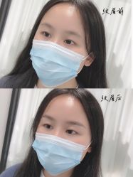 -久匠半永久纹眉