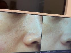 -苑苑vbeauty科技美容SPA