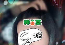 -大麦微针植发全国连锁