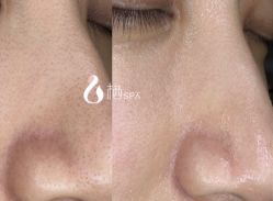 -栖SPA·ONDA ·海菲秀·皑皑科技美肤中心