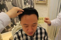 点击看大图 -大麦微针植发丨全国连锁