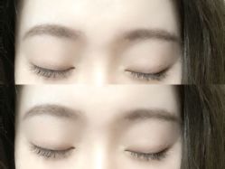 点击看大图 -宥莉·ULLY 痘敏肌•科技皮肤管理中心