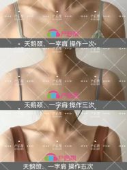 -产后帮产后修复(首城国际店)