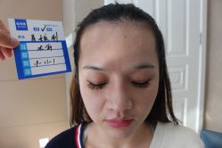 -大麦微针植发丨全国连锁