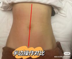 -Lily纤美·科技减脂中心