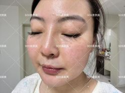 -SOS修丽可.痘肌修复中心
