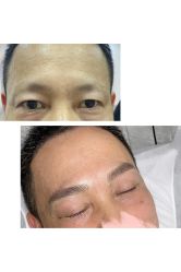 点击看大图 -Verywang半永久纹眉•仪器野生眉