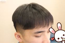 点击看大图 -大麦微针植发丨全国连锁