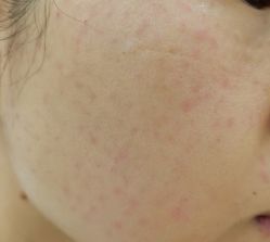 -新美荟医美·专注面部美学抗衰