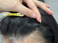 -武汉大学中南医院(总院区)