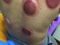 -沈师傅盲人按摩工作室(密三小区店)