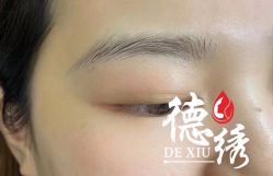 -德绣·机器野生眉发际线·美瞳线半永久