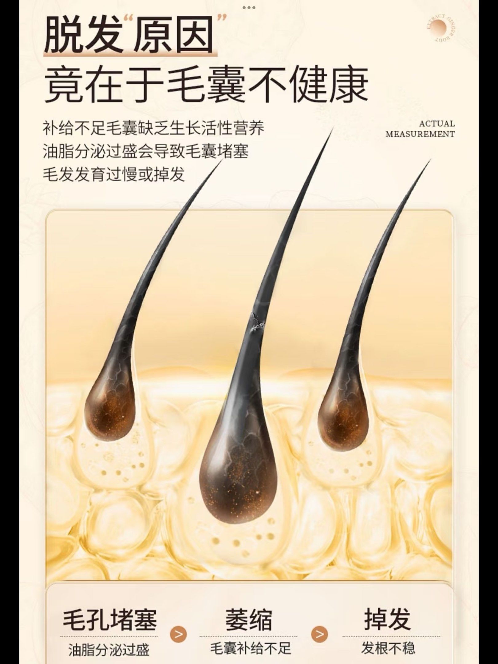 头皮结构大揭秘,你get了吗?