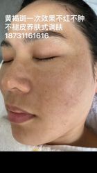 -+MS卓美丝专业祛痘·皮肤管理中心