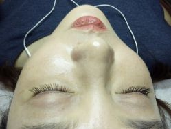 睫毛嫁接-光SPA科技美肤