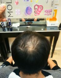 -唐风采假发补发定制
