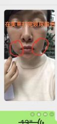 -广州美莱医疗美容医院