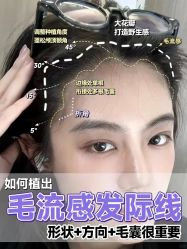 -大麦微针植发全国连锁