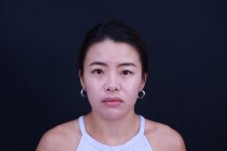 -丰联丽格医疗美容·联合丽格眼整形中心