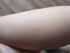 -波塞冬旅游度假区