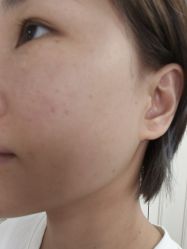 -广州美莱医疗美容医院