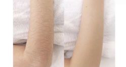 -中科妍美专业脱毛美肤连锁机构