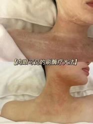 -黎蓓露·徒手骨雕蛋白抗衰·调肤管理